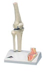3B Scientific Anatomical Model - mini knee joint with cross section of bone on base - Includes 3B Smart Anatomy